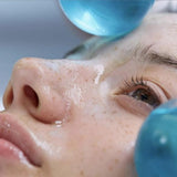 Hieloterapia y Lifting facial