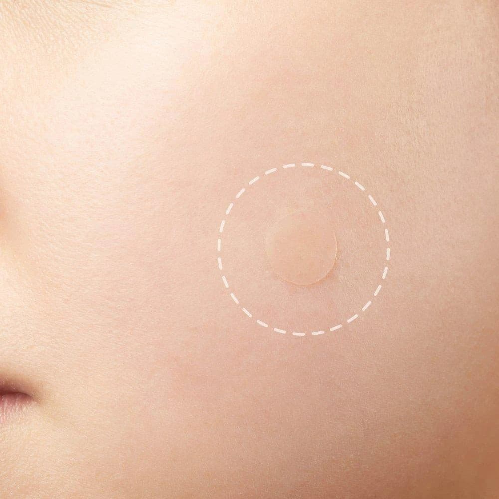 Acne Pimple Master Patch.